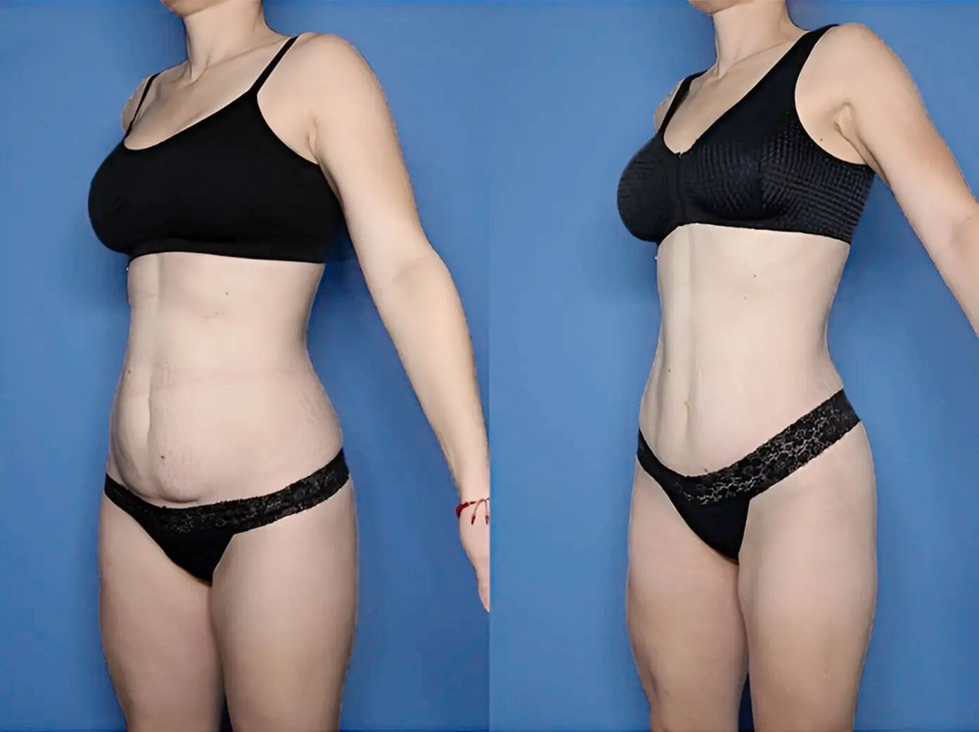 Chirurgische Techniken Dr. Adamskaya Plastische und Ästhetische Chirurgie