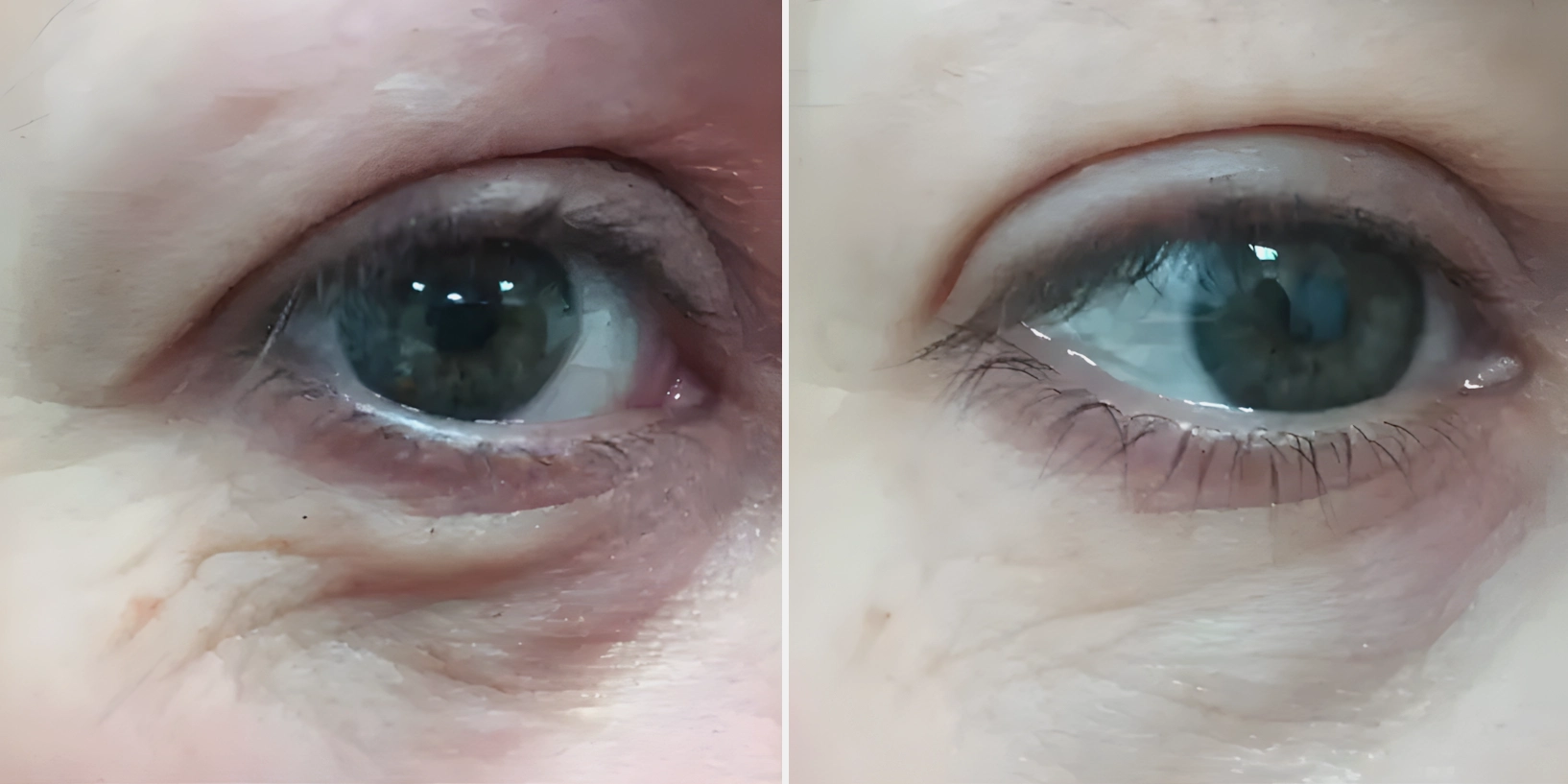 Smooth Eye Dr. Adamskaya Plastische und Ästhetische Chirurgie Wien