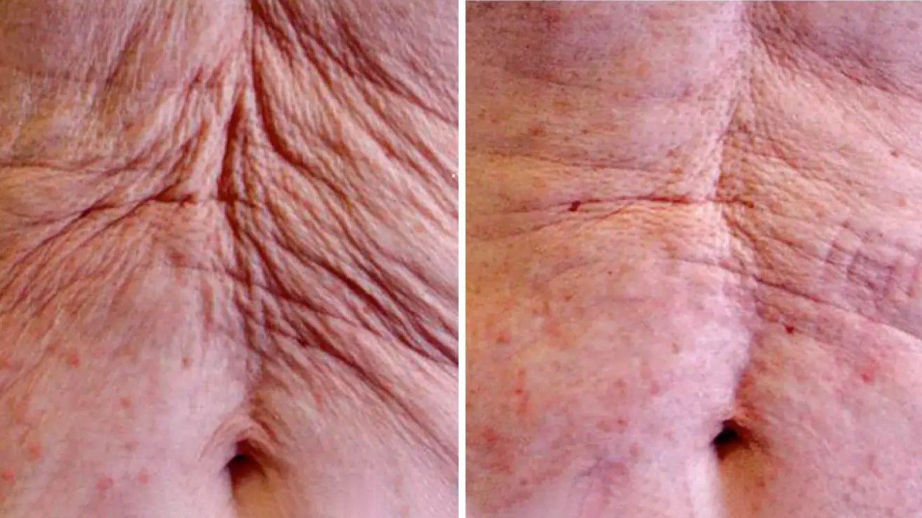 Körperformung Dr. Adamskaya Plastische und Ästhetische Chirurgie Wien A