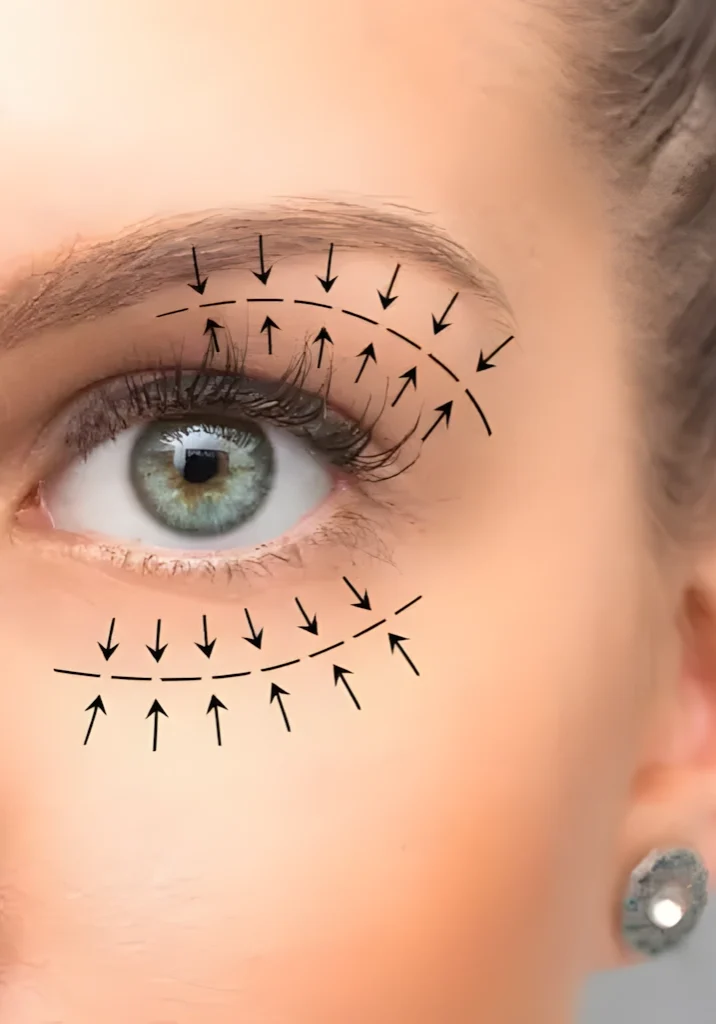 Eyelid Lift Lines Dr. Adamskaya Plastische und Ästhetische Chirurgie Wien