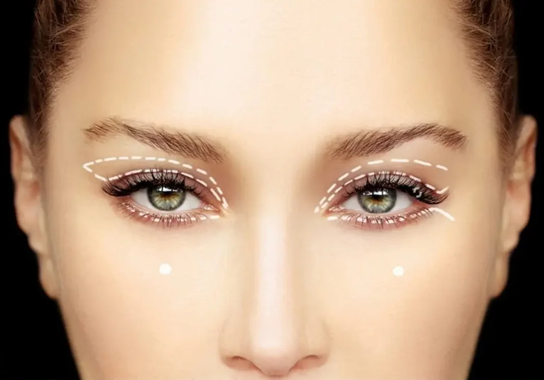 Eyelid-Lift Dr. Adamskaya Plastische und Ästhetische Chirurgie Wien